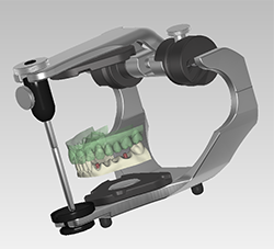 articulator type p