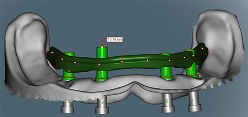 cylinder height