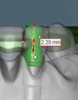 cylinder shoulder height