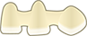 full-contour implant bridge icon