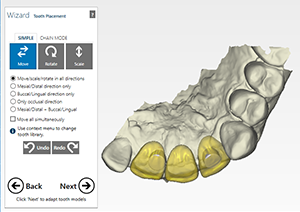 example tooth placement