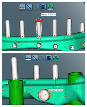 retention elements