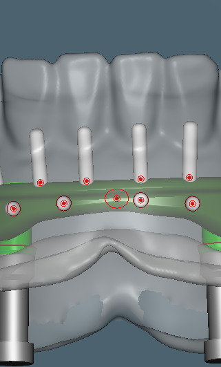 retention pins