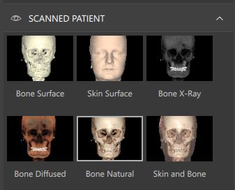 scanned patient
